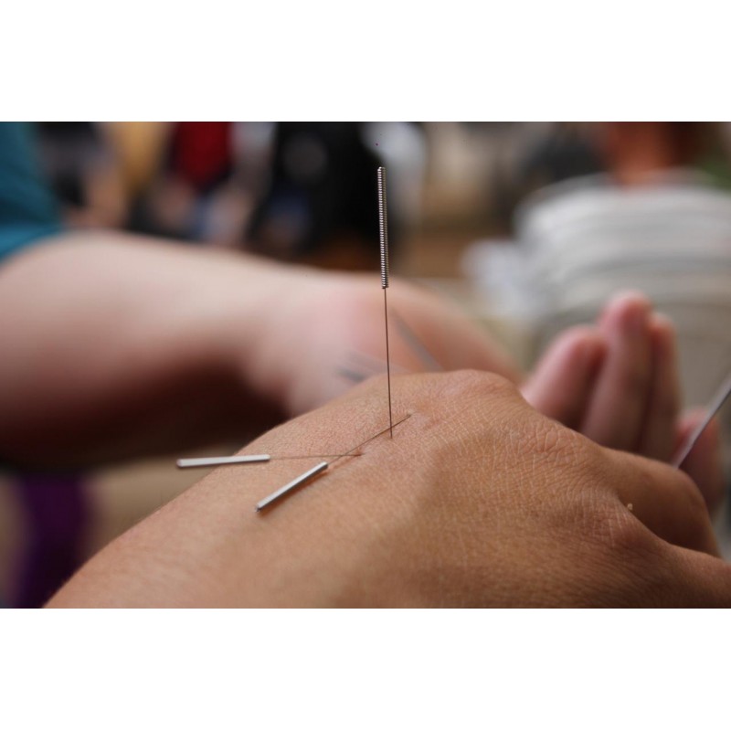 Acupuncture à la main